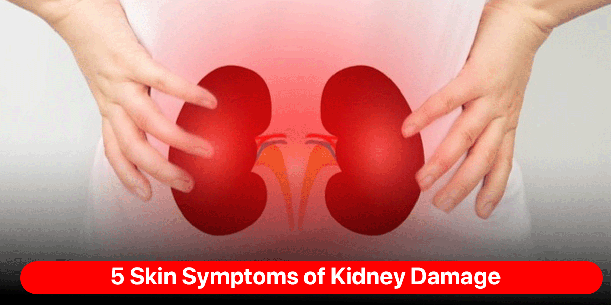 5 Skin Symptoms of Kidney Damage