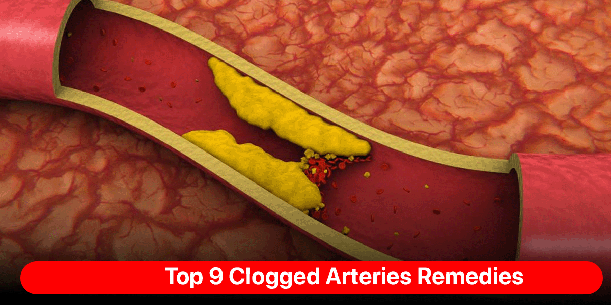 Clogged Arteries Remedies